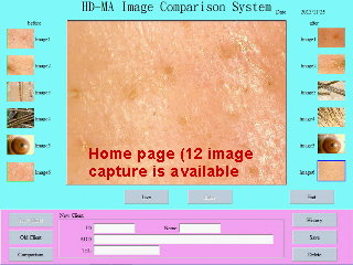 Image comparison system